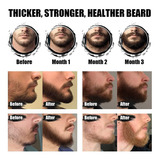 Kit De Crecimiento De Barba Para Hombres, Aceite De Barba, B