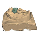 Escaneo Intraoral - Impresiones 3d Dental - Diseño 3d