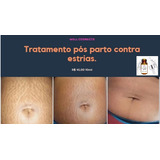 Removedor De Estrias(peeling Ácido Retinoico) Wel Cosmeticos