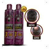 Dom Pelo Shampoo Nixidil Kit  Com 2 Un 250 Ml Cada