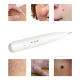 Laser Plasma Ponto Caneta Toupeira, Remover Sardas E Tatuage