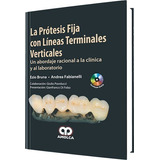 La Prótesis Fija Con Líneas Terminales Verticales. Clín. Lab