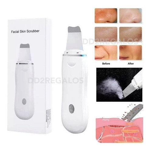 Espátula Facial Ultrasónica Peeling Skin Scrubber Recargable