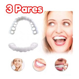 3sonrisa Carillas Cosmética Instantánea Reparación Dientes