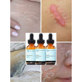 Tratamento Melasma/estrias Kit Completo De Peeling3d + Vit C