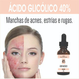 Acido Glicólico 40% Peeling Clareador Rugas Acne Frasco 50ml