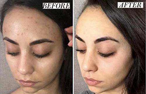 Crema Correctora De Manchas Oscuras Para La Cara.