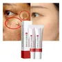 / Crema For Manchas Oscuras En La Cara, Cremas For Quitar /