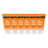 Combo X6 Neutrogena Acne Proofing Gel Exfoliante 100 Ml