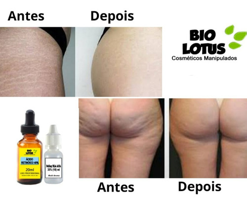 Redutor Manchas/ Melasma/ Estrias ( Acido Retinoico 40% ) 