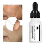 Serum Facial Anti Manchas Rejuvenecedor Corrector Anti Edad 