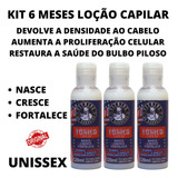 Kit Cuidado Capilar 3 Loção Unissex Nasce Cresce E Fortalece