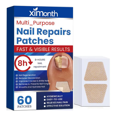 60 Pegatinas Para El Tratamiento De Hongos En Las Uñas De Lo