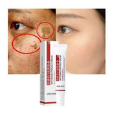 Pomada Creme Removedor Clareador Melasma Manchas Zoo Son