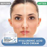 Crema De Ácido Hialurónico - Hidratación Facial De Nicotinam