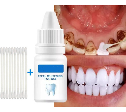 Esencia De Limpieza Bucal Y Blanqueamiento Dental