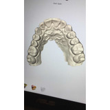 Scanner Dental Intra-oral Planscan. Não É 3shape Cerec