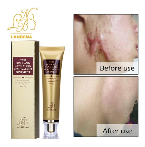 Gel Cicatrices Manchas Estrias Acne Crema No Cicatricure