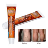 Crema Tratamiento Para Varices Pack 3 