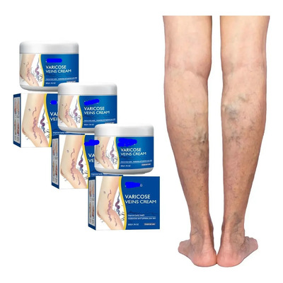 . 3×crema For Venas Varicosas X Spider Varique A | Envío gratis