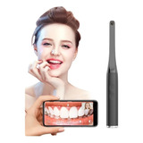 Camera Intra Oral Wifi Wireless Hd Intraoral Luxo Até 12x