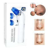 Limpiador Facial Extractor De Puntos Negros Pantalla Digital