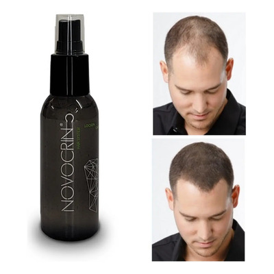 Hacer Crecer El Pelo Rápido Urgente Novocrin Loción 100ml | Meses sin interés