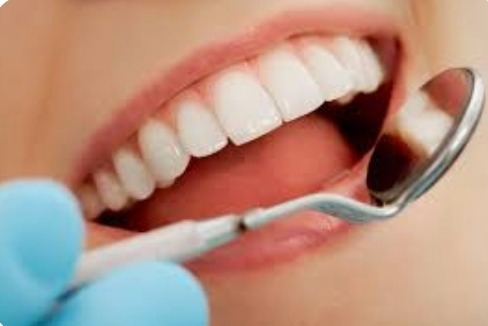 Limpieza Dental Con Ultrasonido - Remoción De Sarro
