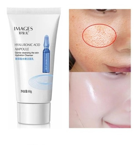 Limpiador Facial Suave Original Hialurónico Anti Acné Grasa 