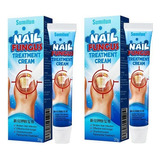 2×crema De Uñas For Onicomicosis Pomada Suave For Quitar Uñ