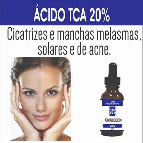 Ácido Tca Ata 20% Acido Tricloroacético Peeling Leve 30ml 