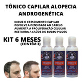 Kit Loção Anti Alopecia Androgenética Nasce Cresce Fortalece