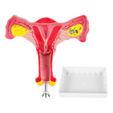 Modelo Anatómico Del Útero, Ovario Y Tubos Femeninos Humanos