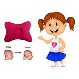  Travesseiro Plagiocefalia Bebê Cabeça Chata Promoção Cores