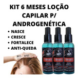 3 Loção Spray Tratamento De Alopecia Androgenética E Caspa!!