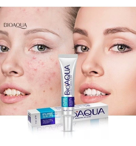 Crema Bioaqua Anti Acné Control Grasa  Granos Espinillas