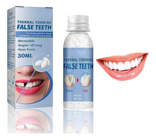 Smile® - Restaurador Dental 30ml Clareamento + Frete Grátis 