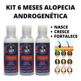 Tratamento Anti Alopecia Androgenética Kit 3 Tônicos Capilar