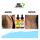 Clareador Corporal Axilas/ Virilhas Mega Promoção  