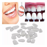 12 Facetas De Resina Esmaltada Para Os Dentes A1 + Massa Fix