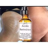 Tratamento Para Estrias (ácido Retinoico 20ml 40%) + Brinde