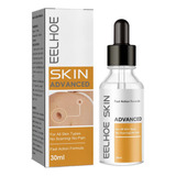 Eficaz Para Eliminar Las Verrugas De La Piel Sensible, 30 Ml