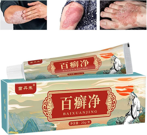 Eczema Psoriasis Crema Con Hierbas Chinas Suaves Naturales,