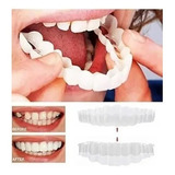 Prótesis Dental Superior E Inferior Snap On Smile Protesis