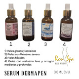 Serum Para Dermapen.4 De 30ml C/u. 