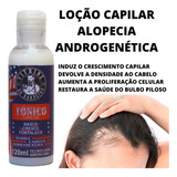 Tratamento Cresce Cabelo Antiqueda Alopécia Androgenética