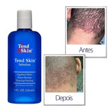 Tend Skin 118ml Loção Para Pelos Encravados E Foliculite