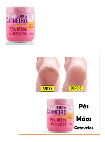 Creme Evitar Rachaduras Dos Pés Ressecamento Da Pele Maciez