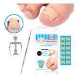 Pegatinas Para Uñas De Los Pies, Kit De Corrección De Uñas E