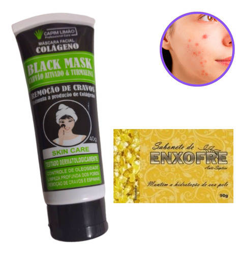 Removedor De Cravos E Espinhas Limpeza Facial Poros +1 Sab